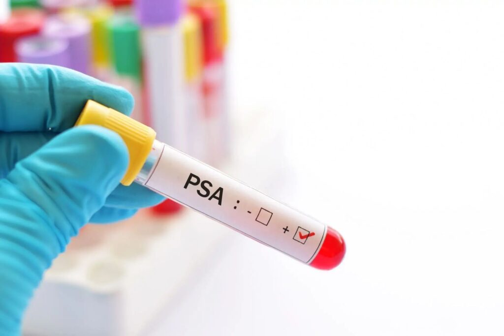Prefeitura de Camdeias divulga cronograma para exames de PSA nas Unidades de Saúde – Imprensa Bahia